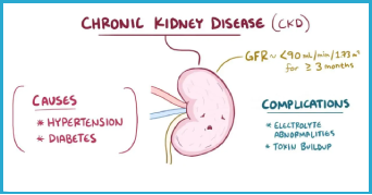 Kidney Stone Surgeon in Patna